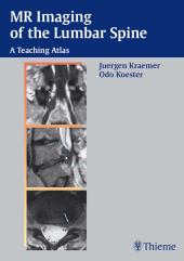 MR Imaging of the Lumbar Spine : A Teaching Atlas (PDF) 2005