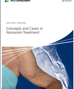 Ebook Concepts and Cases in Nonunion Treatment (AO Trauma Handbooks)