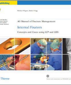 Ebook AO Manual of Fracture Management: Internal Fixators: Concepts and Cases using LCP/LISS