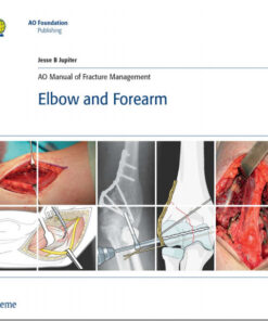 AO Manual of Fracture Management: Elbow & Forearm: Elbow & Forearm