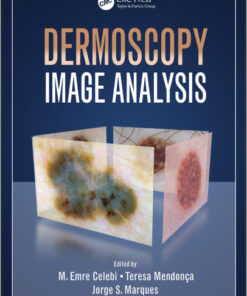 Dermoscopy Image Analysis (Digital Imaging and Computer Vision)