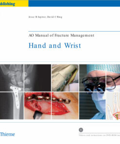 AO Manual of Fracture Management: Hand & Wrist