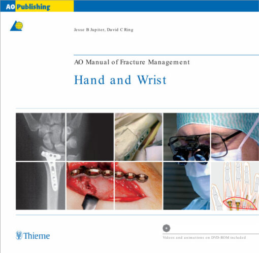 AO Manual of Fracture Management: Hand & Wrist