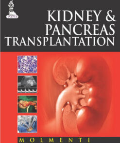 Kidney and Pancreas Transplantation 1st Edition