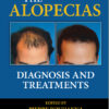 The Alopecias: Diagnosis and Treatments