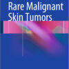 Rare Malignant Skin Tumors 2015th Edition