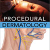 Procedural Dermatology 1st Edition