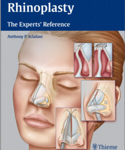 Rhinoplasty: The Experts' Reference 1st Edition