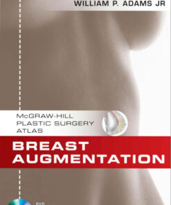 Breast Augmentation (McGraw-Hill Plastic Surgery Atlas) 1st Edition