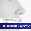 Rhinoplasty: McGraw-Hill Plastic Surgery Atlas