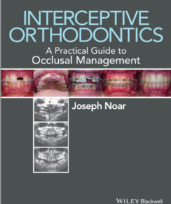 Ebook  Interceptive Orthodontics: A Practical Guide to Occlusal Management