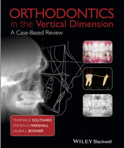 Ebook Orthodontics in the Vertical Dimension: A Case-Based Review