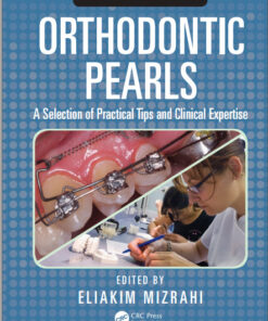 Ebook Orthodontic Pearls: A Selection of Practical Tips and Clinical Expertise 2nd Edition