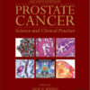 Prostate Cancer, Second Edition: Science and Clinical Practice 2nd Edition