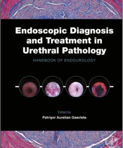 Endoscopic Diagnosis and Treatment in Urethral Pathology: Handbook of Endourology