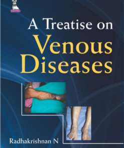 A Treatise on Venous Diseases 1st Edition