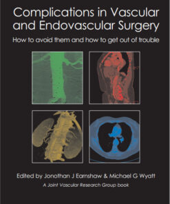 Complications in Vascular and Endovascular Surgery: How to Avoid Them and How to Get Out of Trouble 1st Edition