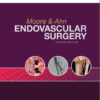 Endovascular Surgery 4th Edition