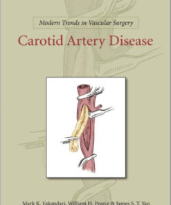 Carotid Artery Disease (Modern Trends in Vascular Surgery) 1st Edition