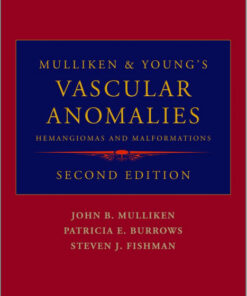 Mulliken and Young's Vascular Anomalies: Hemangiomas and Malformations