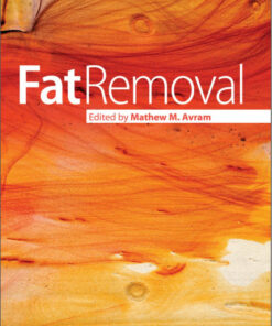 Fat Removal: Invasive and Non-invasive Body Contouring 1st Edition