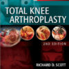 Total Knee Arthroplasty  2nd Edition