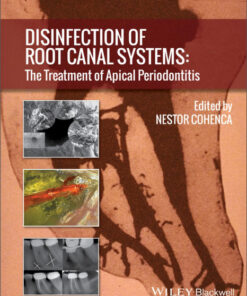 Ebook Disinfection of Root Canal Systems: The Treatment of Apical Periodontitis 1st Edition