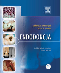 Ebook Endodoncja, Zasady i Praktyka