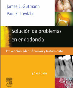 Ebook Solución de problemas en endodoncia: Prevención, identificación y tratamient