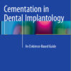 Ebook Cementation in Dental Implantology: An Evidence-Based Guide 2015th Edition