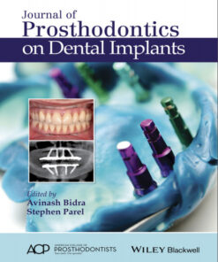 Ebook Journal of Prosthodontics on Dental Implants 1st Edition