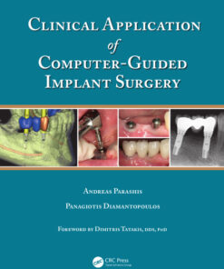 Ebook Clinical Application of Computer-Guided Implant Surgery 1st Edition