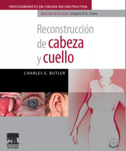 Reconstrucción de cabeza y cuello