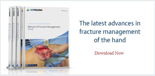 Manual of Fracture Management - Hand 1st Edition