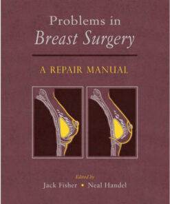 Problems in Breast Surgery: A Repair Manual