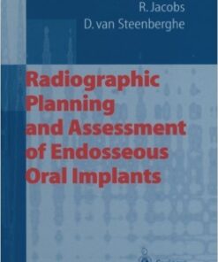 Radiographic Planning and Assessment of Endosseous Oral Implants