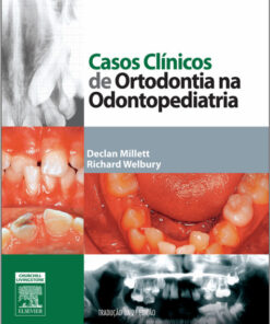 Casos Clínicos de Ortodontia na Odontopediatria