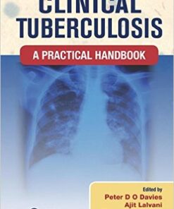 Clinical Tuberculosis: A Practical Handbook