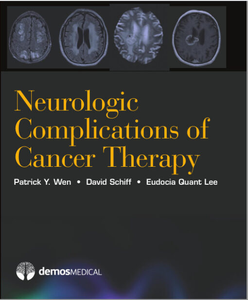 Neurologic Complications of Cancer Therapy 1st Edition