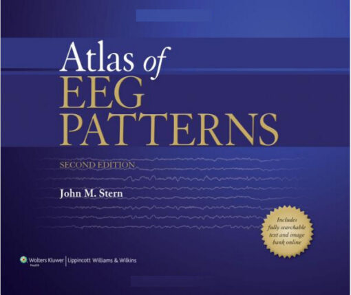 Atlas of EEG Patterns Second Edition