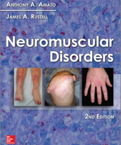 Neuromuscular Disorders, 2nd Edition 2nd Edition