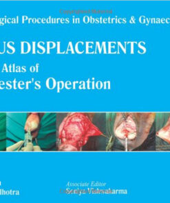 Uterus Displacements: A Colour Atlas of Manchester's Operation 1st Edition