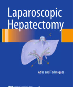 Laparoscopic Hepatectomy: Atlas and Techniques 2015th Edition