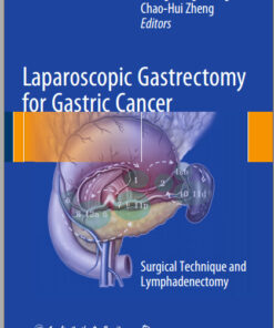 Laparoscopic Gastrectomy for Gastric Cancer: Surgical Technique and Lymphadenectomy 2015th Edition