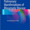 Pulmonary Manifestations of Rheumatic Disease: A Comprehensive Guide