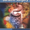 Nutrition and Bariatric Surgery 1st Edition