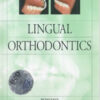 Lingual Orthodontics