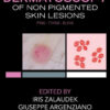 Dermatoscopy of Non-Pigmented Skin Tumors: Pink - Think - Blink