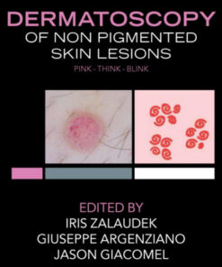 Dermatoscopy of Non-Pigmented Skin Tumors: Pink - Think - Blink