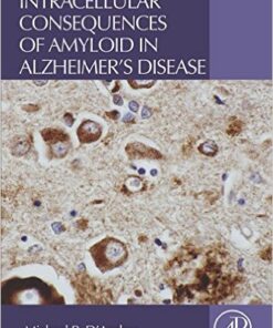 Intracellular Consequences of Amyloid in Alzheimer's Disease 1st Edition